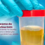 Exame de Urina EAS: Detecção de Problemas Renais